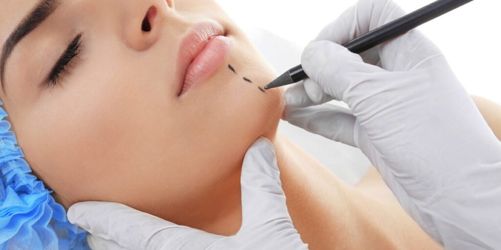 perfiloplastia